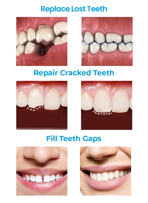 Sonrisa Confiable | Kit de Reparación Dental