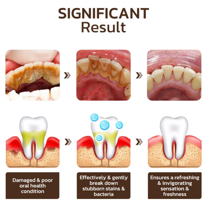 Niacinamide | Crema Dental Blanqueadora